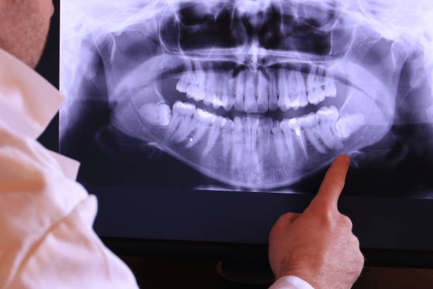 Best Broken Tooth Emergency  in Tipton, IA