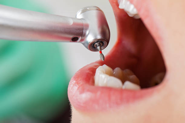 Best Knocked-Out Tooth Emergency  in Tipton, IA